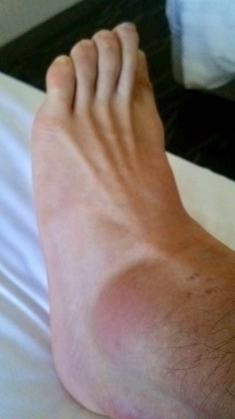 marta shitaye feet 2