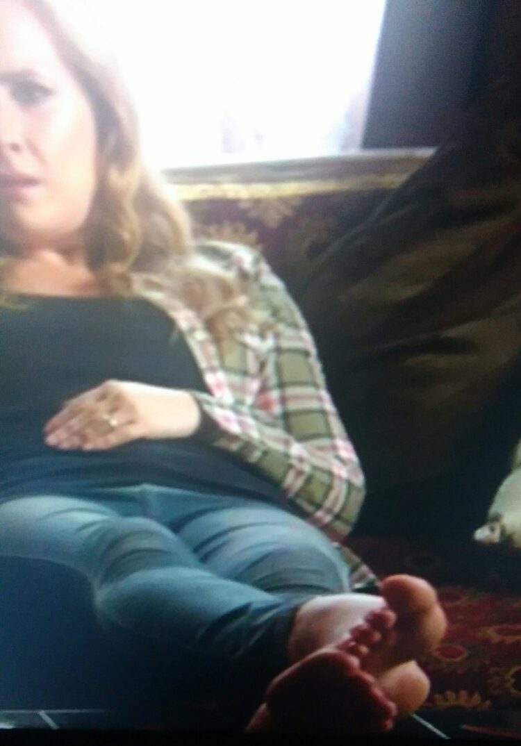 martha howe douglas feet scaled