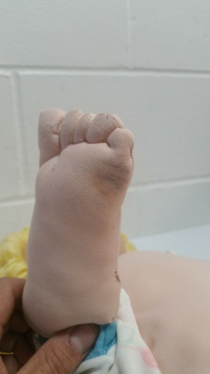 martha thomas feet 2