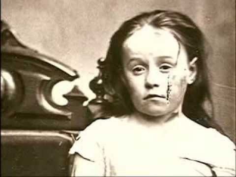 mary ellen wilson feet 2