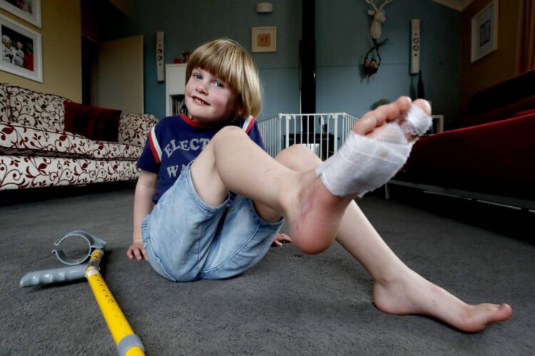 mary johnston feet 2