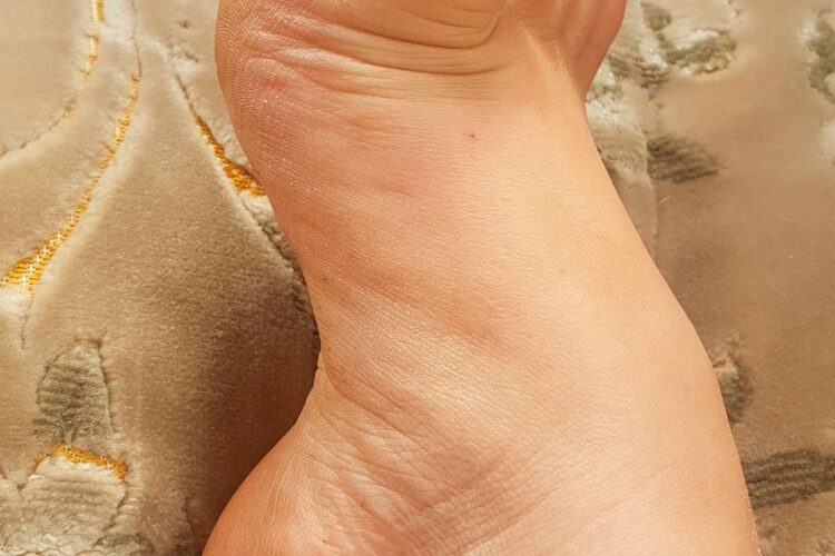 mary johnston feet 5