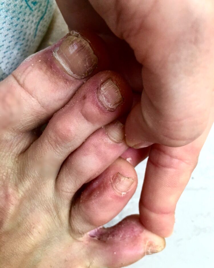 mathilde froustey feet 3