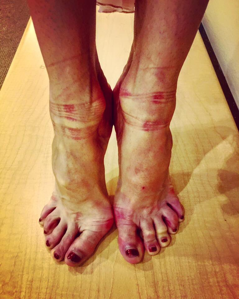 mathilde froustey feet