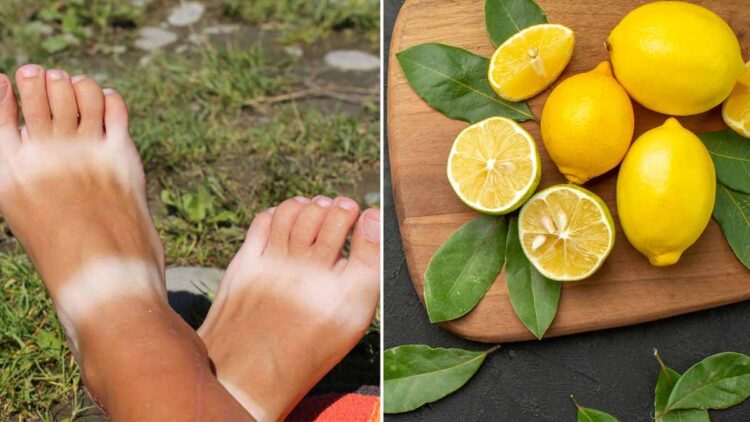 may lemon feet