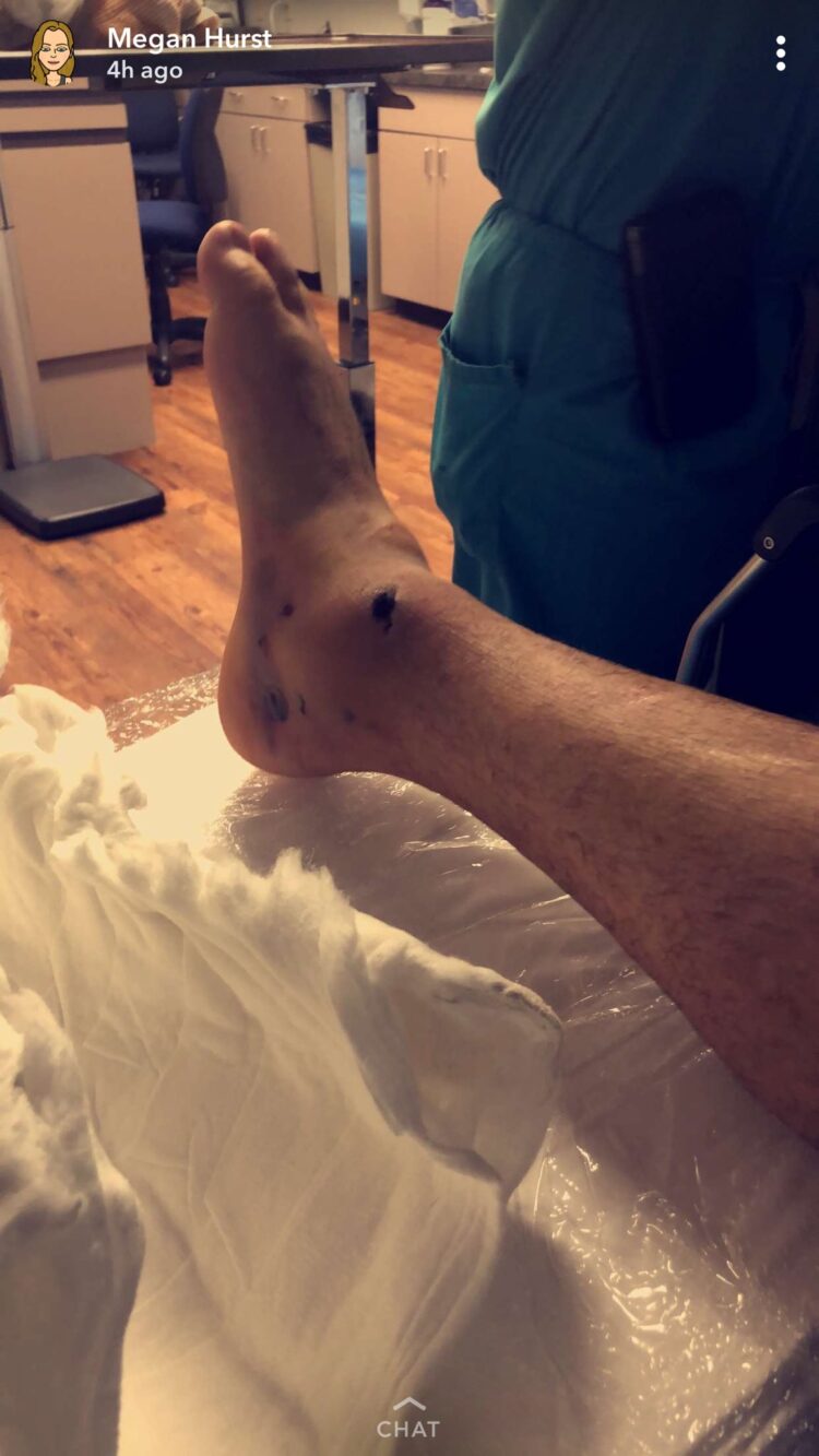 megan hurst feet 2