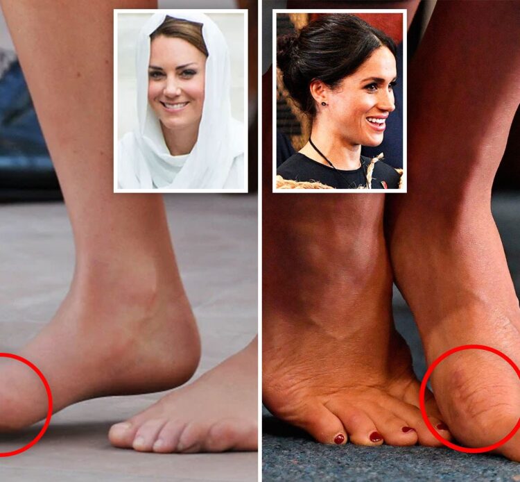 meghan markle feet 2