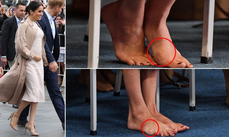 meghan markle feet 6