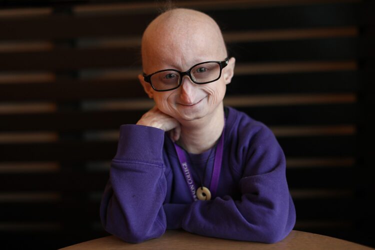 meghan waldron feet scaled