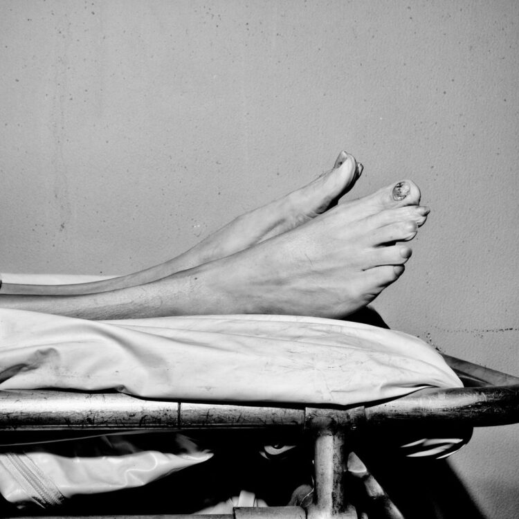 melania puntas feet 6