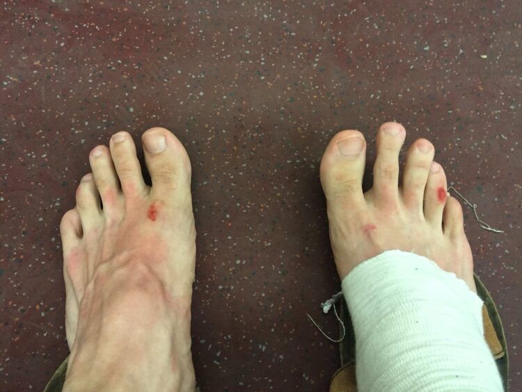 melanie shatner feet 3