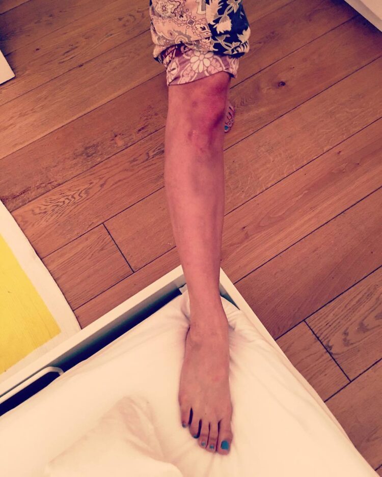 melia kreiling feet 1