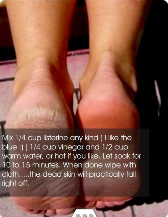 melissa cabrera feet 4