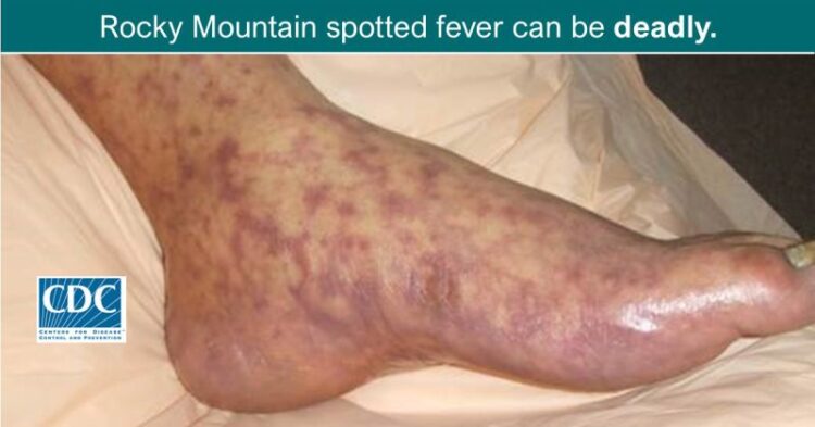 melissa camacho feet