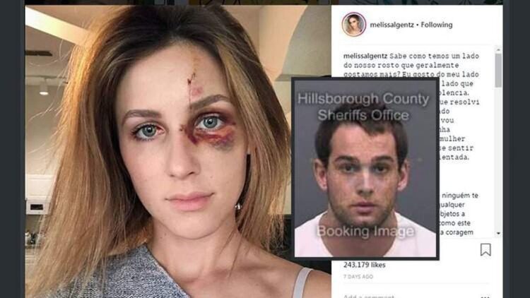 melissa gentz feet 5