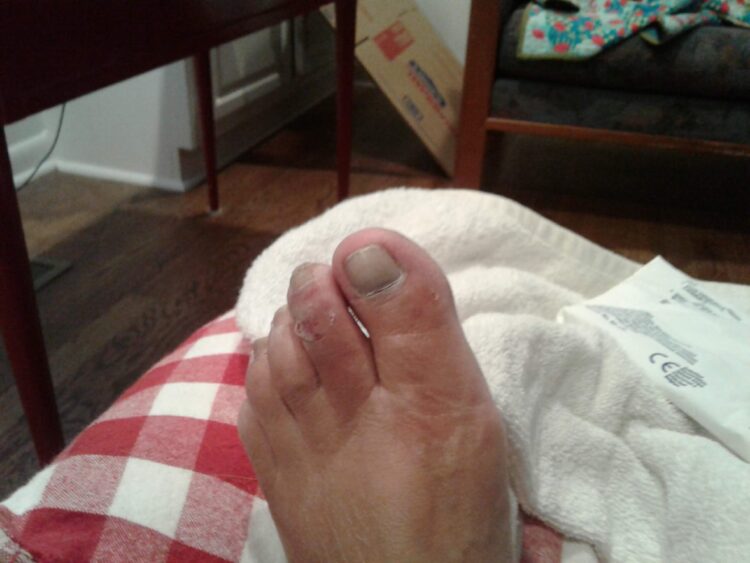 melody johnson feet scaled