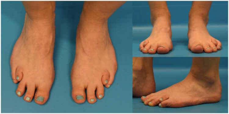 micheli fernandes feet 3