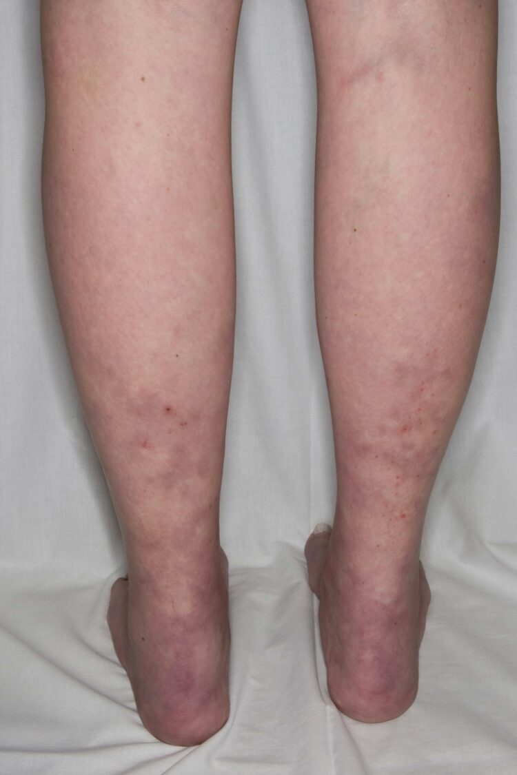 michi virgilio feet 4 scaled