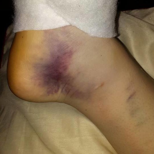 mickie knuckles feet 5