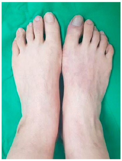 mihaela pantea feet 6