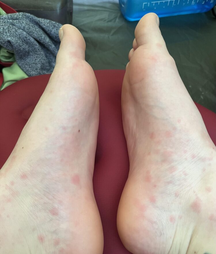 mild anis fc feet 1 scaled