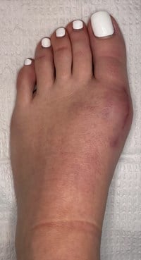 milleni nicoli feet 1