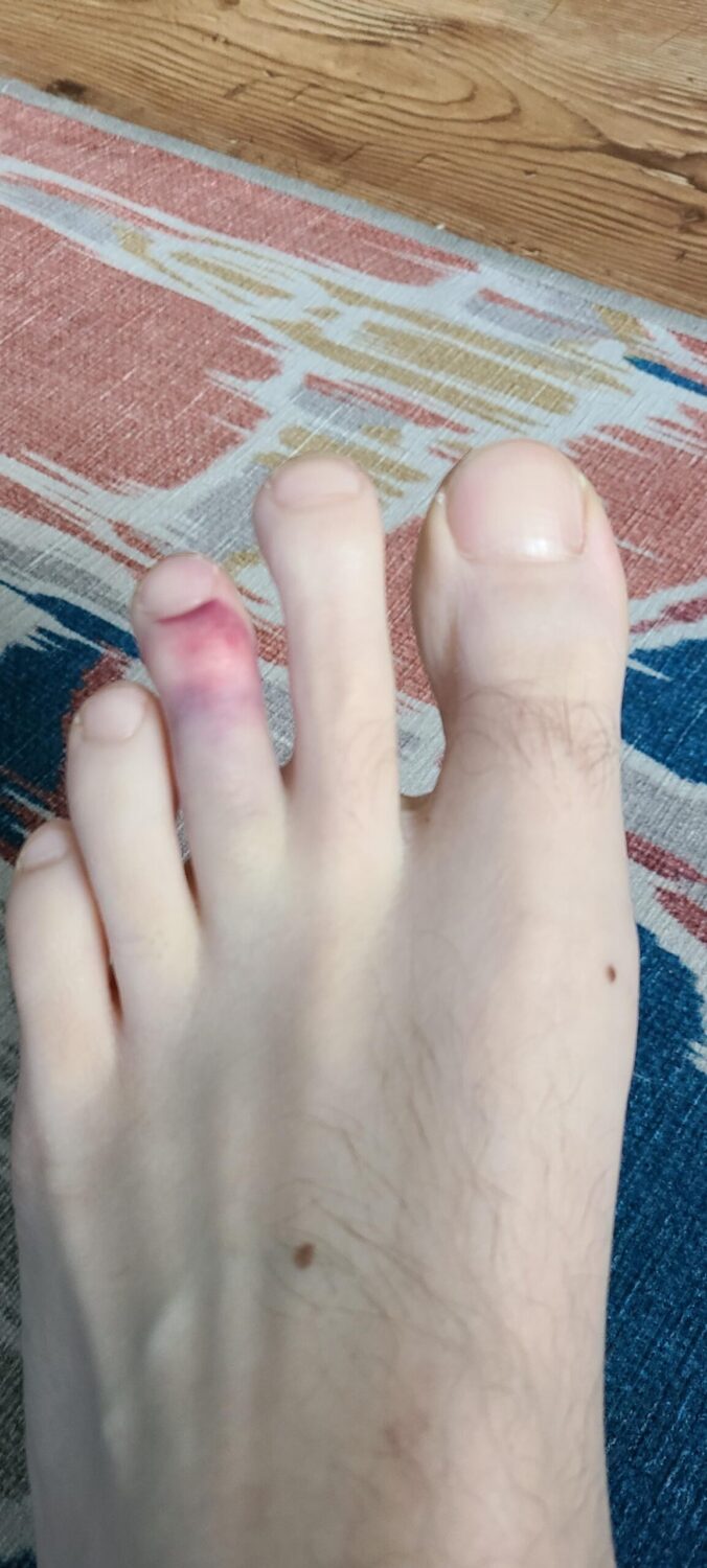 millie orourke feet 3 scaled