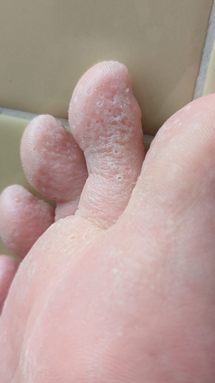 millie turvey feet 5 scaled