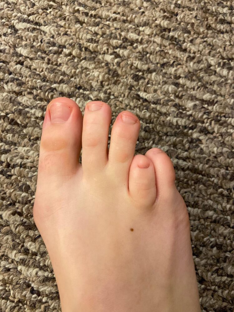 miss twisted feet 6 scaled