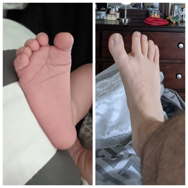 miss weirdly feet 5
