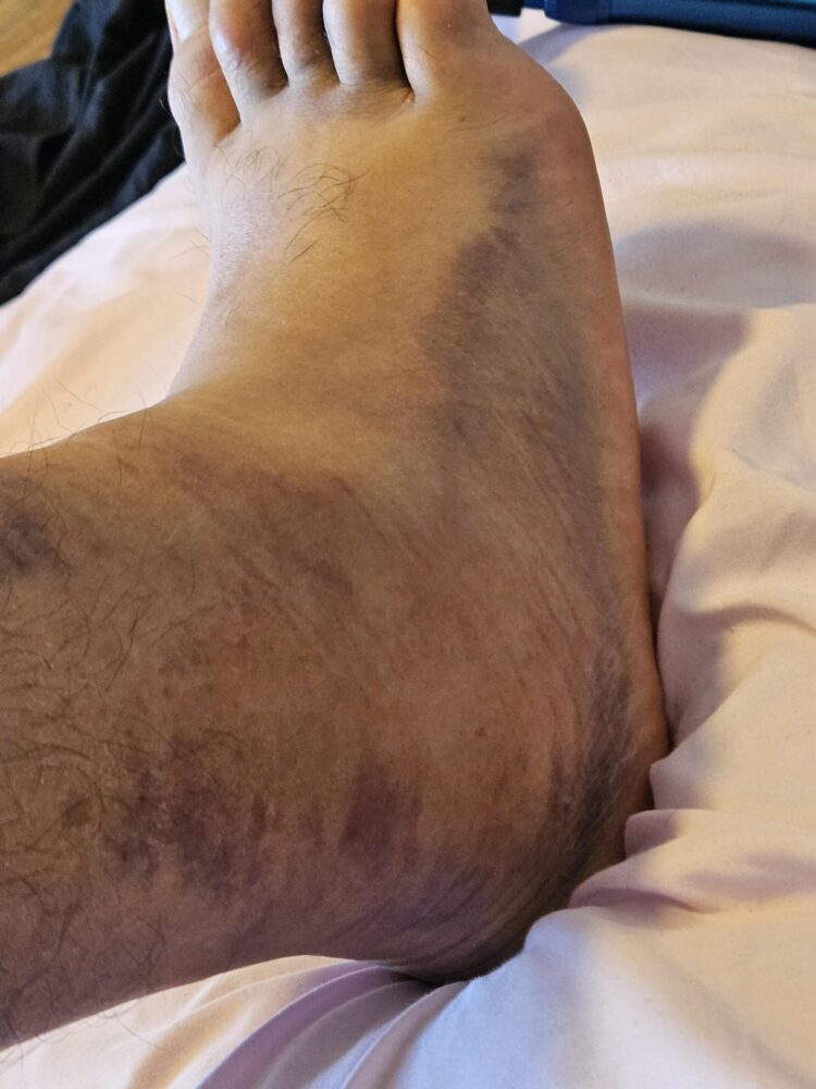 monn mosh feet 1 scaled