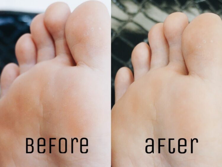ms kuan feet 2