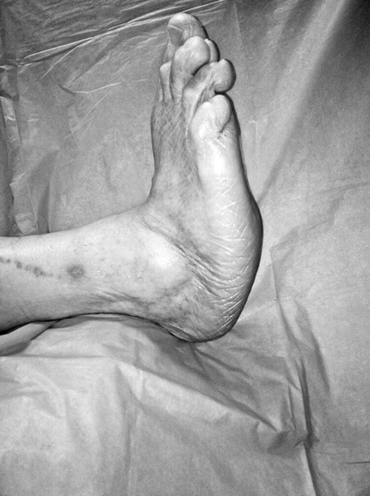 muhammad samir al lami feet 4