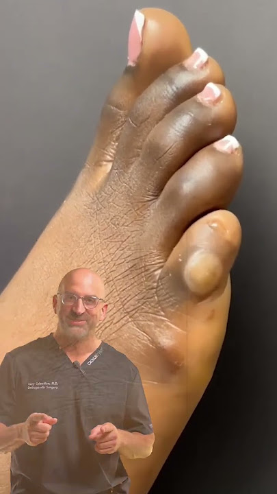 munchiedentist feet 2