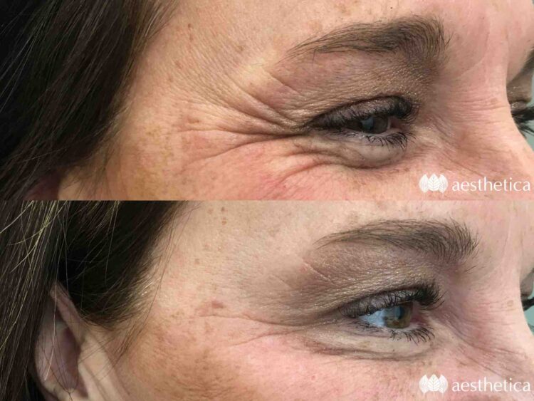 natalie garcia feet 4