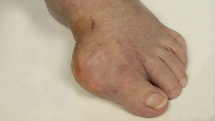 natalie swallow feet 1