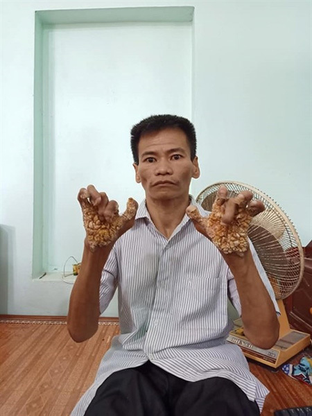 nguyen lan chi feet 4