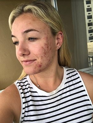 nicola inger scruby feet 6