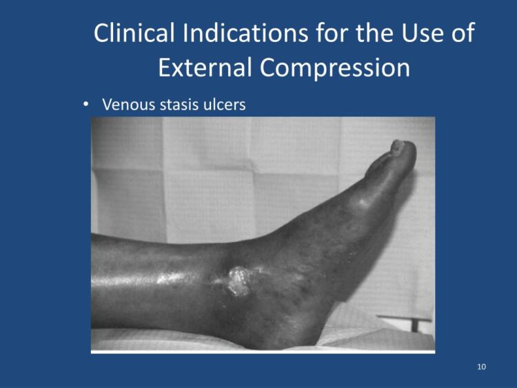 nor asmawati abdullah feet 3