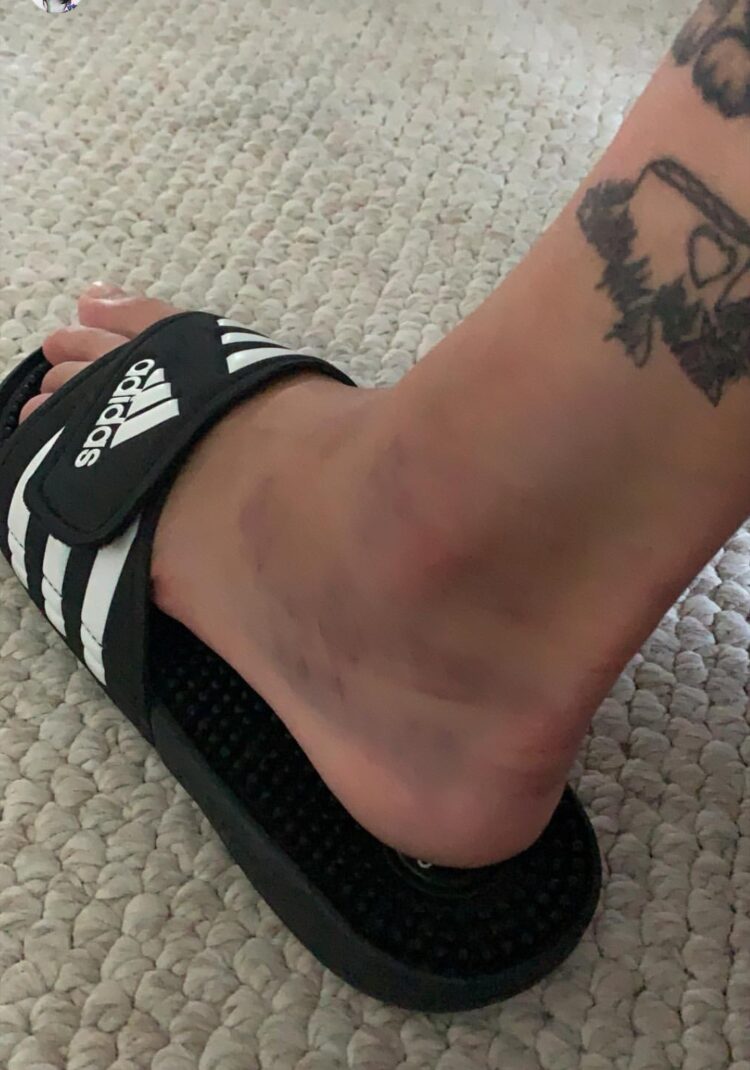 nora vasconcellos feet 1