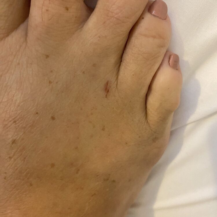 nova van brussel feet 6