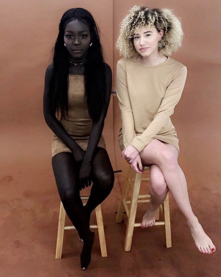 nyakim gatwech feet 3