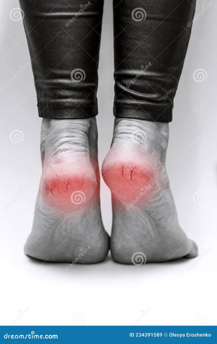 olesya evdokimova feet 6