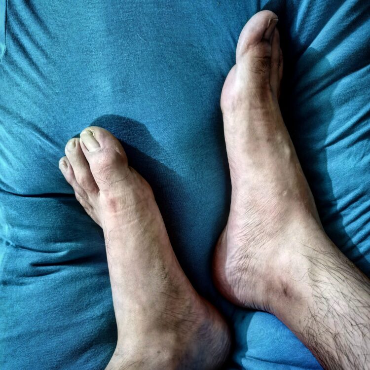 panxita feet 1 scaled