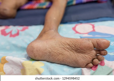 patientce foster feet 2