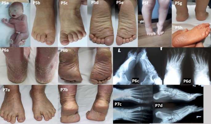 patientce foster feet 3