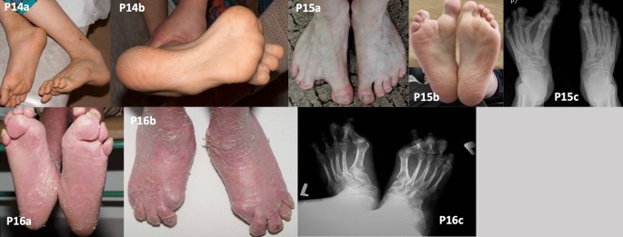 patientce foster feet 4