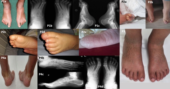 patientce foster feet 5