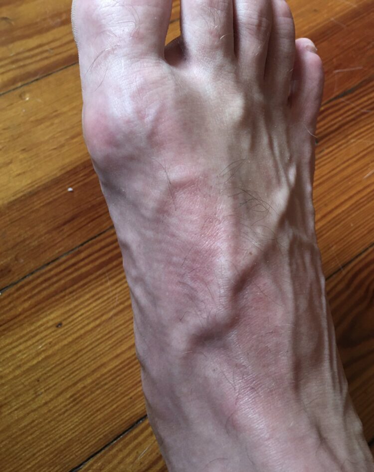 patricia lockwood feet 1