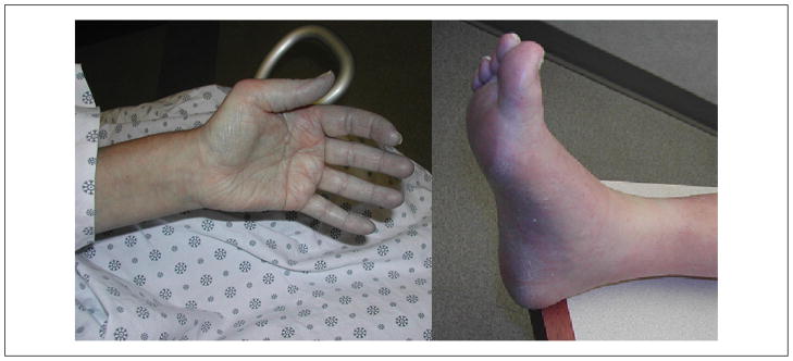 patricia nielitz feet